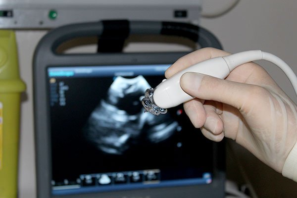Ocular ultrasonography